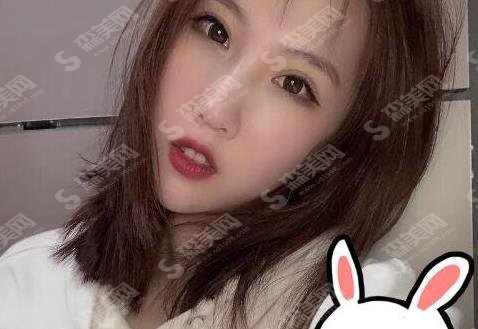 西南医院王量技术如何?双眼皮案例图集分享及个人简介