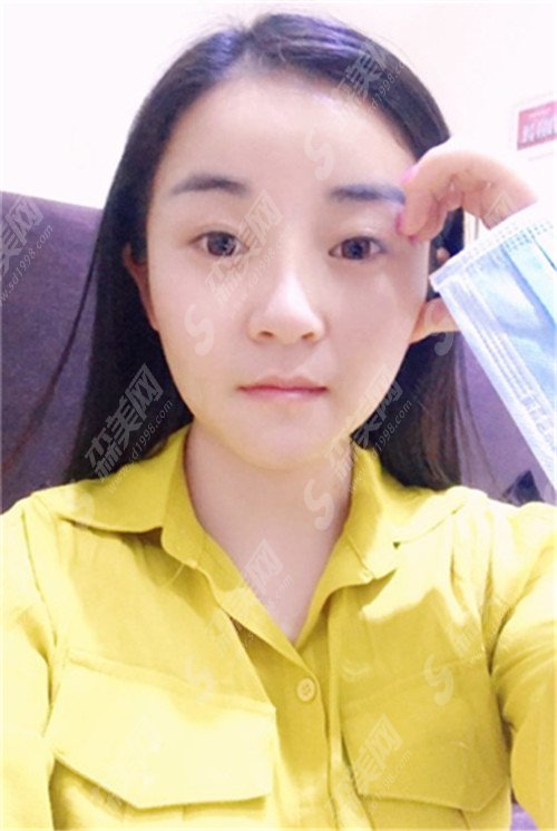 【2021全新】哈医大二院激光祛斑价格表，哈医大二院医生介绍+案例