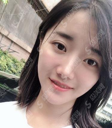 天津医院朱宝骥隆鼻技术好不好?个人简介/案例分享/价格