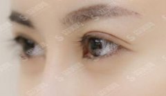 上海九院做双眼皮哪个专家比较好？实力医生对比，2021名单公布