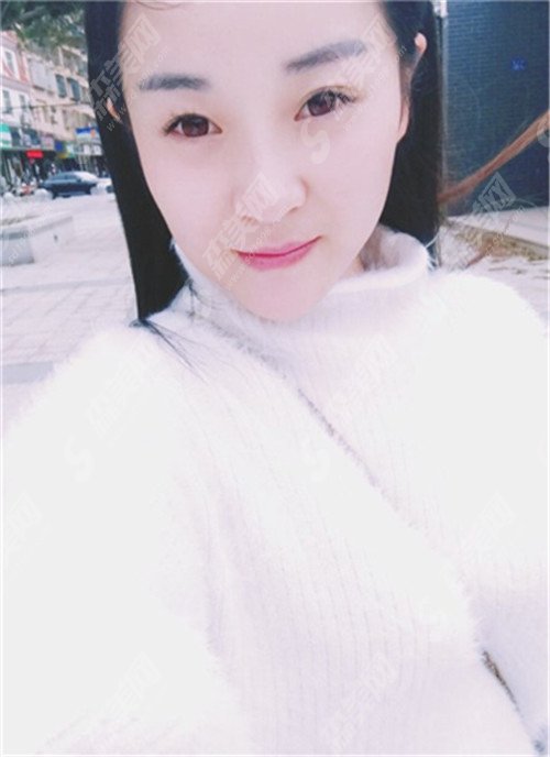 葫芦岛颐正整形价目表,附医院双眼皮案例恢复果图+医院介绍