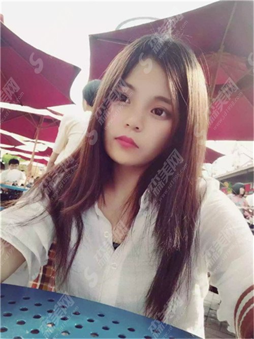大坪医院整形美容科果好吗?较棒医院专家介绍+案例及价格表