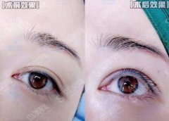 武汉双眼皮修复医生排名前十名单，医生简介，整形前必备小知识不要错过呦！