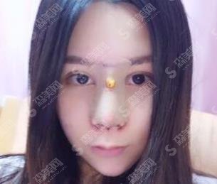 刘中策医生整形案例分享，医生信息了解/价格查询/案例分享