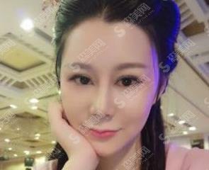 刘中策医生整形案例分享，医生信息了解/价格查询/案例分享