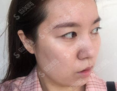 东部战区总医院袁斯明在哪些方面技术好?案例分享/个人简介