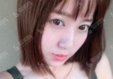 东部战区总医院袁斯明在哪些方面技术好?案例分享/个人简介