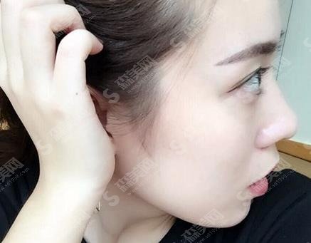 东部战区总医院袁斯明在哪些方面技术好?案例分享/个人简介