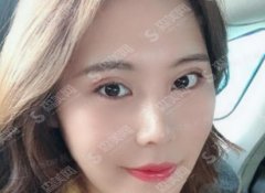 上海双眼皮修复较厉害医生名单，今日详解，整形必了解！