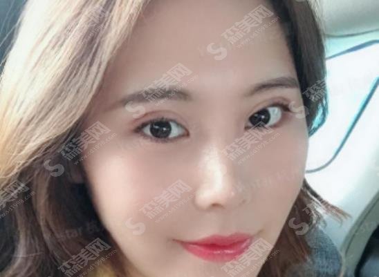 上海双眼皮修复较厉害医生名单，今日详解，整形必了解！