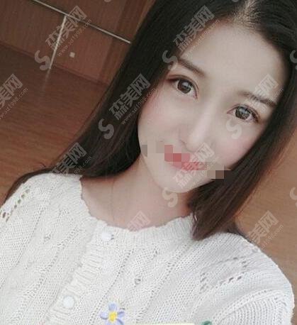 贵州省人民医院皮肤科案例果优异，揭秘果如何炼成!较新价格表一览