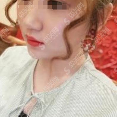 费县美容医院做光子嫩肤哪家强?山东费县人民医院位居第一!