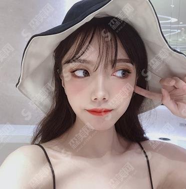 杨丽双眼皮做的可以吗?热乎的个人简介来咯~其所在的郑大二院整形外科口碑可以吗?