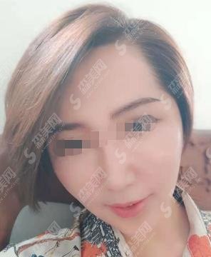 碧莲盛和雍禾植发哪个口碑更好？雍禾做的植发果如何？专家介绍和案例果分享