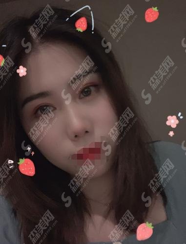 2021美白价格多少？西安美莱案例反馈及价格表明细