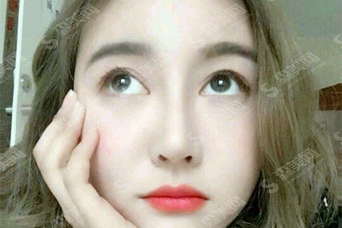 沈阳整形外科三甲医院有哪些?上榜的医院综合实力介绍,内含隆鼻手术案例的恢复果图!