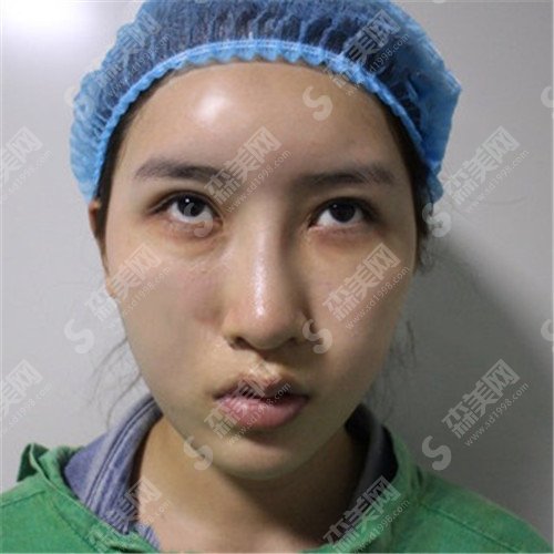 阿克苏第一人民医院医学美容科什么情况?美容科的口碑好吗?没有没成功的例子分享?
