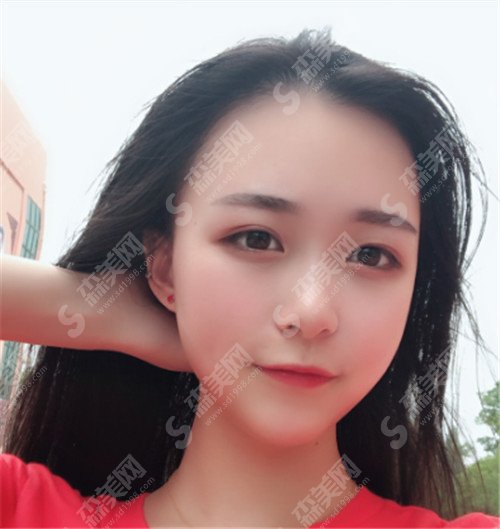 福州市第一医院整形科价格表如何?医院整形专家盘点+恢复案例