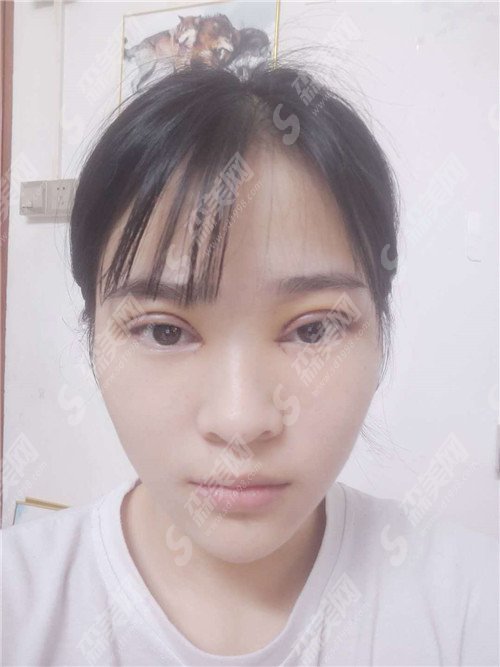 广州军区总医院整形科价格表2021较新呈现!附院内专家+案例+照片