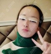 苏州大学附属第一医院（苏大附一院）整形美容外科价格表，进行了眼部手术获得了精致五官！