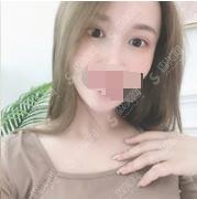 西安西京医院洗眼线价格表明细，内附医院介绍医院案例分享