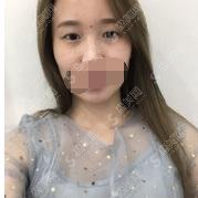 西安西京医院洗眼线价格表明细，内附医院介绍医院案例分享
