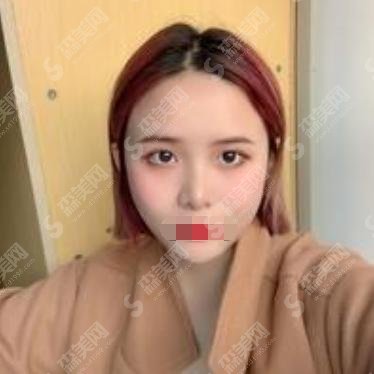 山西正规医院三甲医院哪个整容拉皮去皱做的好？内附医院介绍及价格明细一览