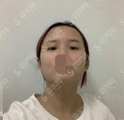 山西正规医院三甲医院哪个整容拉皮去皱做的好？内附医院介绍及价格明细一览