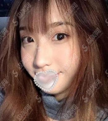 八大处美容整形价目表分享,双眼皮项目做得较为不错!真实案例不容错过!