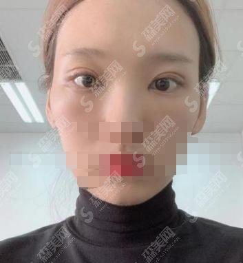 西安西京医院整形全新价格表（价目表）出炉，案例果值得一看！