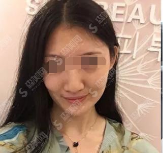 东国水光补水价格是多少？东国水光补水案例果真棒！