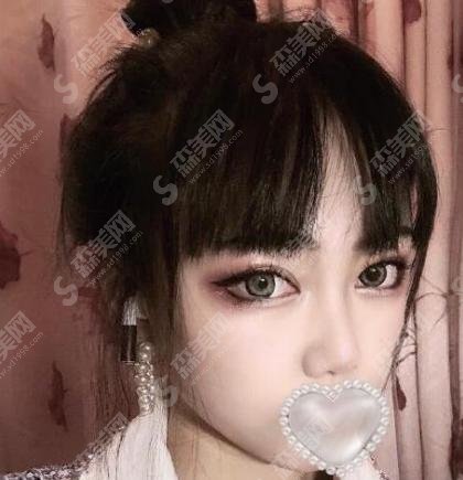 溶解酶溶解玻尿酸多少钱？简直是玻尿酸案例失误的克星！