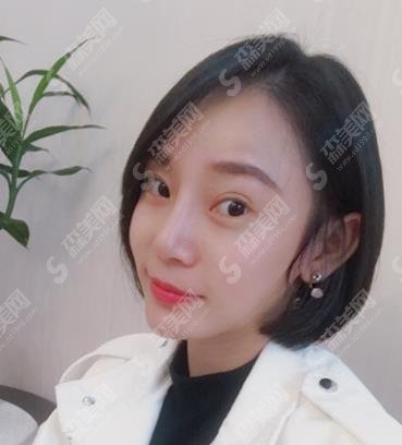 石河子大学医学院第一附属医院整形美容科价格表查询，玻尿酸丰脸颊做的果好吗？