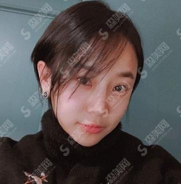 石河子大学医学院第一附属医院整形美容科价格表查询，玻尿酸丰脸颊做的果好吗？