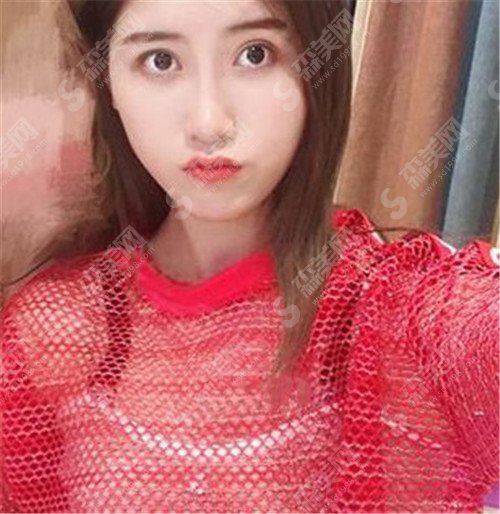 上海九院去疤痕价目表2021版大公开啦!医院名医+真实案例(内附恢复照片)