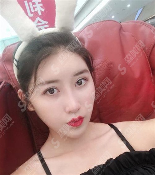 上海九院去疤痕价目表2021版大公开啦!医院名医+真实案例(内附恢复照片)