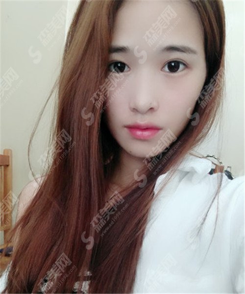 2021年北京大学第一医院激光整形科价格表+医院医生介绍+真实案例(恢复照片)