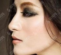 郑州正规的磨骨整形医院有哪些？上榜名单都有谁呢，一起看一下！