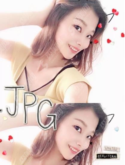 贵阳市口腔医院价格表查询,含牙齿矫正基本流程及照片对比