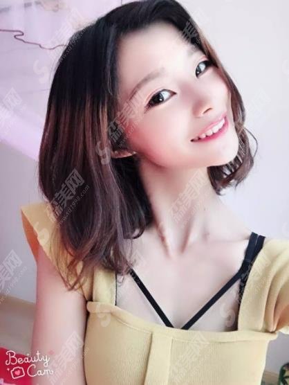 贵阳市口腔医院价格表查询,含牙齿矫正基本流程及照片对比