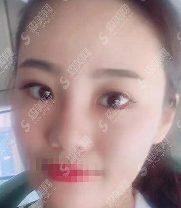 中南大学湘雅医院整形美容科如何？手术价格指标有变化？建议收藏了解