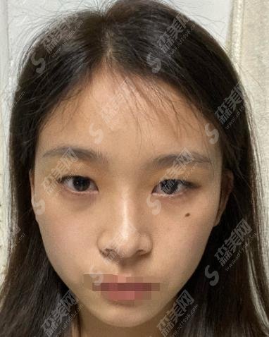 常州市第三人民医院整形美容外科价格表意外曝光，田文清医生倾力操作，做出巨大贡献