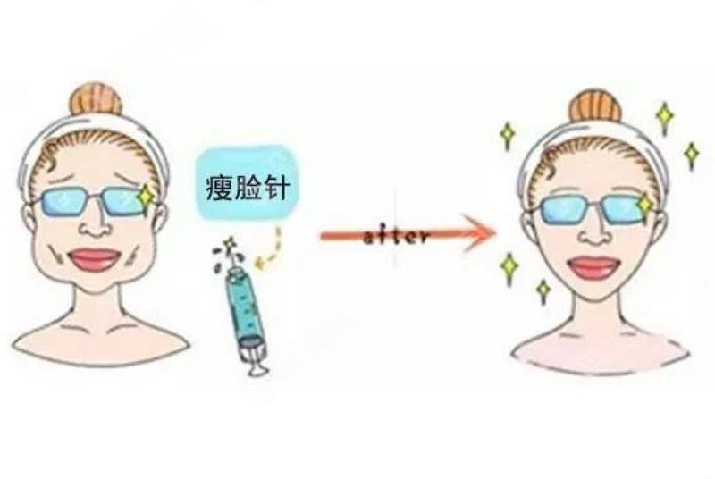 打了注射瘦脸一年后图片，你一定没有见过，来看看吧！