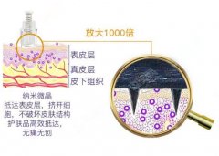 全脸毛孔粗大做纳米微晶和微针哪个好？纳米微晶推荐给你，具体原因看文章