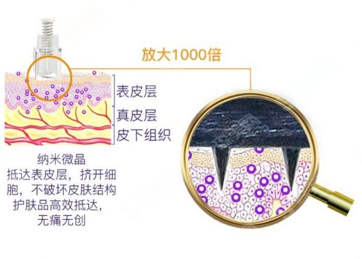 全脸毛孔粗大做纳米微晶和微针哪个好？纳米微晶推荐给你，具体原因看文章