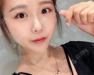 壹心医学美容整形吸脂瘦脸做的如何？案例真实点评及照片对比