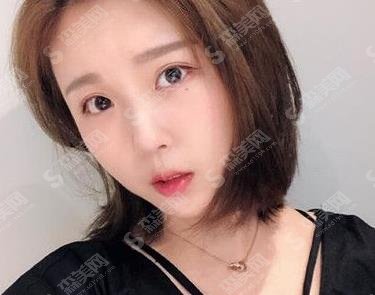 壹心医学美容整形吸脂瘦脸做的如何？案例真实点评及照片对比