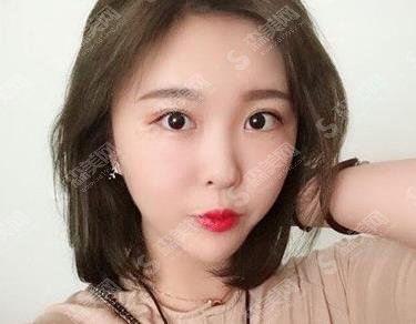 壹心医学美容整形吸脂瘦脸做的如何？案例真实点评及照片对比