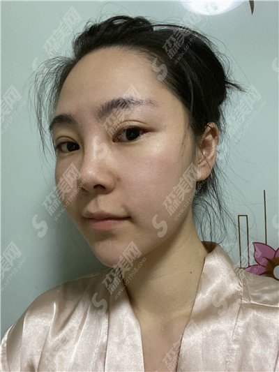 长沙做鼻子较好的医生排名是怎么样的？丁翔医生、田芳斌医生、秦晓东医生均已上榜,哪位是适合你的医生那？