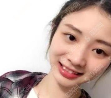 天津医科大学口腔医院牙齿矫正怎么样?矫正进程如何?需要矫正的时间长吗?价格公布